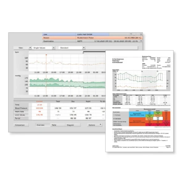 18B 1 Seca Screen 300 Abpm With Software