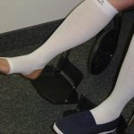 Elderly Leg Skin Protector - Image 3