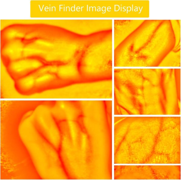 6A 31 Portable Blood Vessel Finder