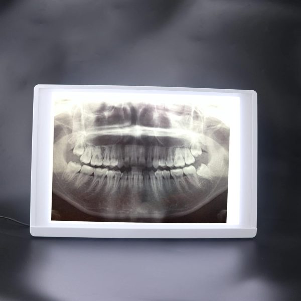 X-Ray Film Illuminator Light