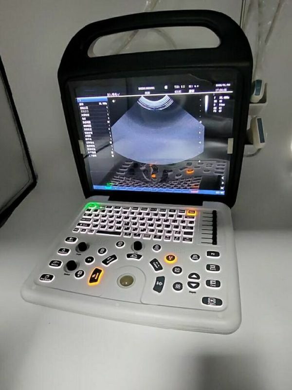 Ultrasound Color Doppler