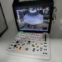 Ultrasound Color Doppler