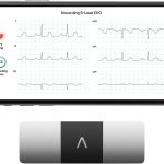 6-Lead Personal EKG Monitor