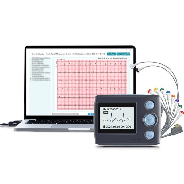 12 Lead Holter Monitor Recording