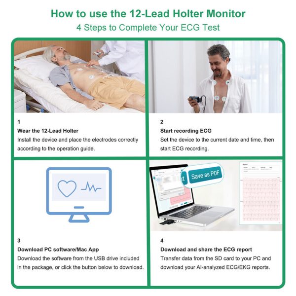 27B 12 Lead Holter Monitor Recording