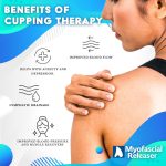 Professional Cupping Therapy Set - Image 3