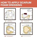 Bordered Sacrum Silicone Foam Dressing - Image 4