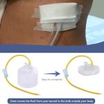 Disposable Wound Drainage Bulb
