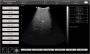 CONTEC Veterinary Portable Ultrasound - Image 5