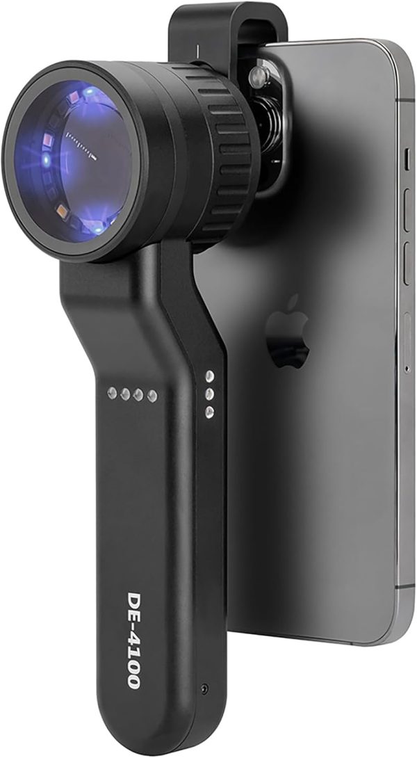 Woods Lamp Dermatoscope For Dermatologist - Image 4