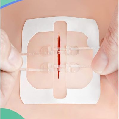 Emergency Wound Closure Device