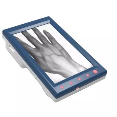 Vein Finder LCD Display