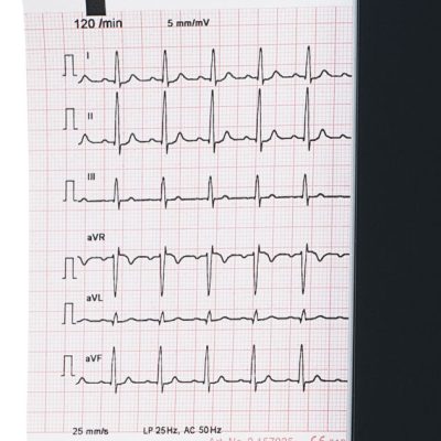 ECG Paper for all seca