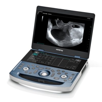 Mindray MX7 Ultrasound System