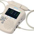 Ultrasonic Blood Flow Monitor
