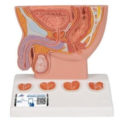 3B Prostate Model