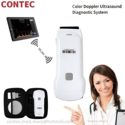 Color Doppler Handheld Ultrasound